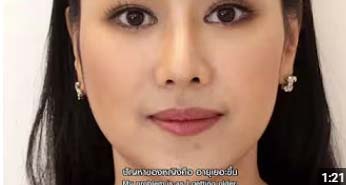  Lift and tighten the face