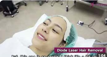 Soprano Ice Hair Removal Treatment